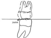 Manual Illustration